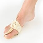 NEOG511 Bunion Correction system 3 | Injury Supports